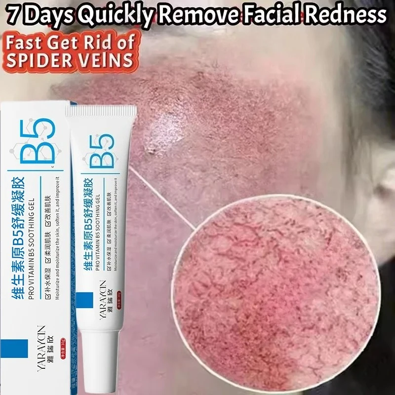 Facial Redness Repair Cream Improve Sensitive Skin Dryness Moisturizer Hydrating Sooth Lotion Removal Rosacea Korean Cosmetics Facial Redness Repair Cream Improve Sensitive Skin Dryness Moisturizer Hydrating Sooth Lotion Removal Rosacea Korean Cosmetics