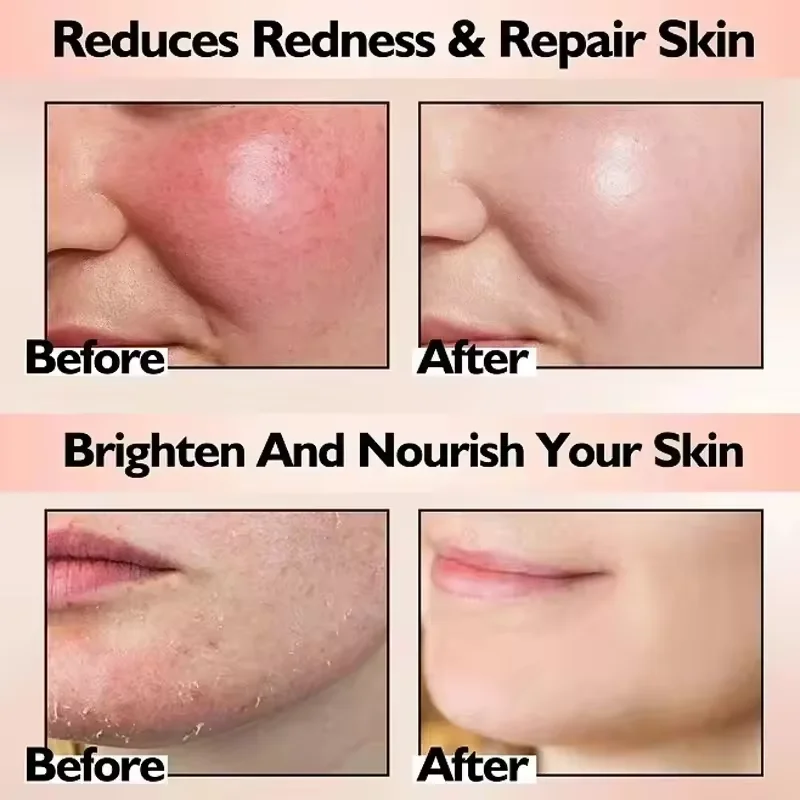 Facial Redness Repair Cream Improve Sensitive Skin Dryness Moisturizer Hydrating Sooth Lotion Removal Rosacea Korean Cosmetics Facial Redness Repair Cream Improve Sensitive Skin Dryness Moisturizer Hydrating Sooth Lotion Removal Rosacea Korean Cosmetics - Image 2
