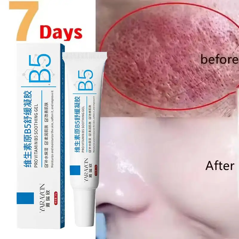 Facial Redness Repair Cream Improve Sensitive Skin Dryness Moisturizer Hydrating Sooth Lotion Removal Rosacea Korean Cosmetics Facial Redness Repair Cream Improve Sensitive Skin Dryness Moisturizer Hydrating Sooth Lotion Removal Rosacea Korean Cosmetics - Image 3