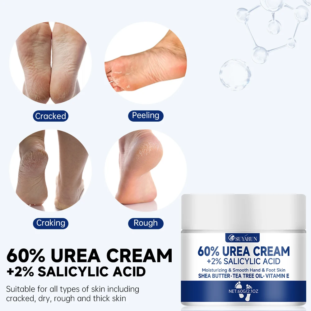 Suyarun 60 % Harnstoff-Fußcreme Für Rissige Fersen Und Trockene Haut – Intensive Feuchtigkeitsspendende Behandlung, Hornhautentferner, Diabetische Fußpflege. Suyarun 60 % Harnstoff-Fußcreme Für Rissige Fersen Und Trockene Haut – Intensive Feuchtigkeitsspendende Behandlung, Hornhautentferner, Diabetische Fußpflege. - Image 5