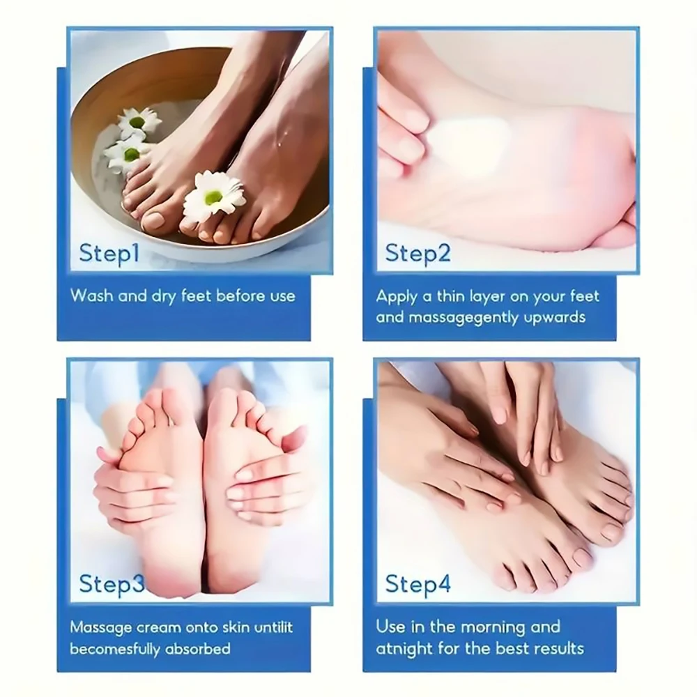 Suyarun 60 % Harnstoff-Fußcreme Für Rissige Fersen Und Trockene Haut – Intensive Feuchtigkeitsspendende Behandlung, Hornhautentferner, Diabetische Fußpflege. Suyarun 60 % Harnstoff-Fußcreme Für Rissige Fersen Und Trockene Haut – Intensive Feuchtigkeitsspendende Behandlung, Hornhautentferner, Diabetische Fußpflege. - Image 6
