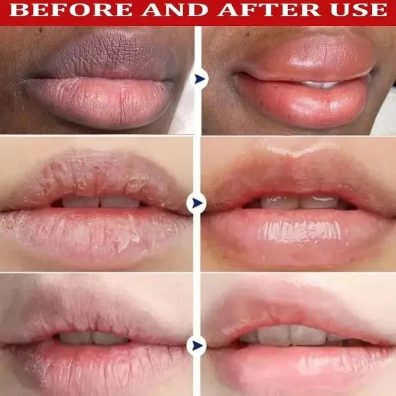 Schnelles Entfernen Dunkler Lippenbalsam-Serum, Hellt Melanin Auf, Lippenmaske, Peeling, Verblasst Lippenlinien, Abgestorbene Haut, Nährende Reparatur, Lippenpflege, Make-Up Schnelles Entfernen Dunkler Lippenbalsam-Serum, Hellt Melanin Auf, Lippenmaske, Peeling, Verblasst Lippenlinien, Abgestorbene Haut, Nährende Reparatur, Lippenpflege, Make-Up - Image 2