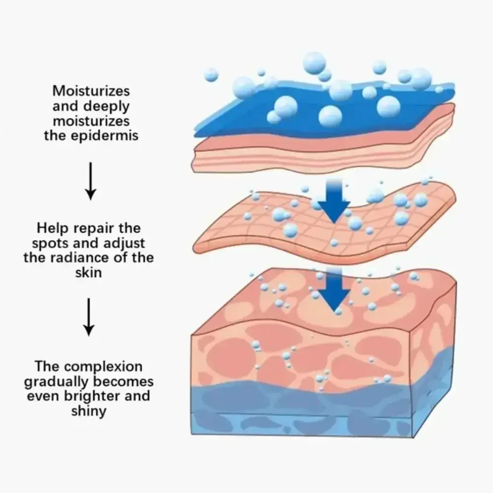 Bleaching Sommersprossen Gesichtscreme Entfernung Melasma Dunkle Flecken Korrektor Aufhellen Melanin Pigmentierung Aufhellen Anti-Aging Schönheit Pflege Bleaching Sommersprossen Gesichtscreme Entfernung Melasma Dunkle Flecken Korrektor Aufhellen Melanin Pigmentierung Aufhellen Anti-Aging Schönheit Pflege - Image 6