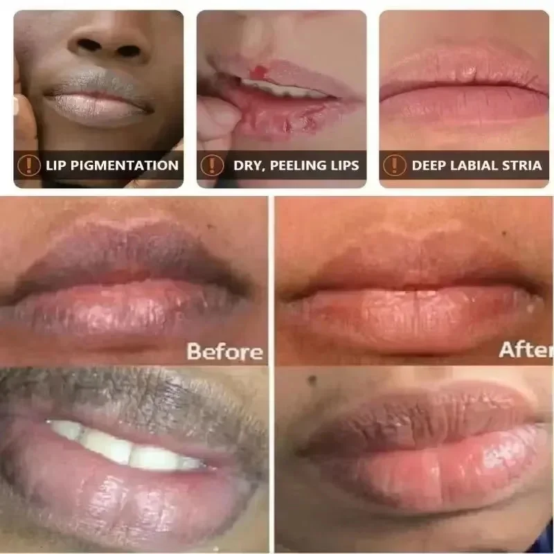 Schnelles Entfernen Dunkler Lippenbalsam-Serum, Hellt Melanin Auf, Lippenmaske, Peeling, Verblasst Lippenlinien, Abgestorbene Haut, Nährende Reparatur, Lippenpflege, Make-Up Schnelles Entfernen Dunkler Lippenbalsam-Serum, Hellt Melanin Auf, Lippenmaske, Peeling, Verblasst Lippenlinien, Abgestorbene Haut, Nährende Reparatur, Lippenpflege, Make-Up - Image 3