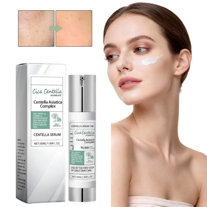 100/300/700 Centella Asiatica Serum, High-Efficiency Moisturizing Lotion Correcting Glow Serum, Centella Asiatica Plumpness Skin 100/300/700 Centella Asiatica Serum, High-Efficiency Moisturizing Lotion Correcting Glow Serum, Centella Asiatica Plumpness Skin